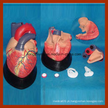 Grande dimensão Educação Médica Modelo Anatômico do Coração Humano (7 PCS)